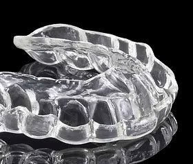 Férulas de ortodoncia invisible de material termoplástico transparente, diseñadas a medida para la alineación dental.
