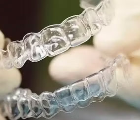 ferula-descarga transparente