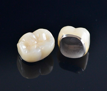 Prótesis dental individual de cerámica con acabado translúcido natural, mostrada sobre una superficie reflectante negra.